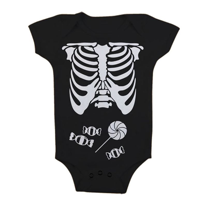 X-Ray Body