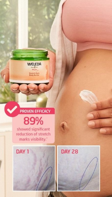 Stretch Mark Body Butter 150 ml, Weleda